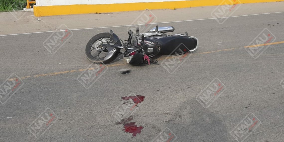 Motociclista grave en accidente
