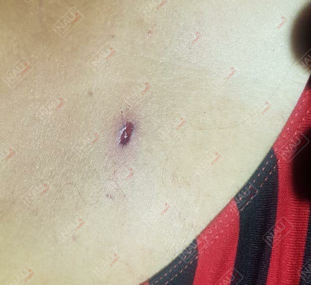 No fue Rayo, fue un balazo que recibió una señora el pasado 23 de junio