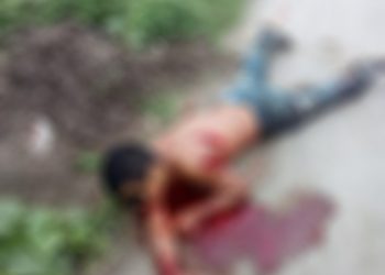 Le dieron 6 machetazos y aún vive