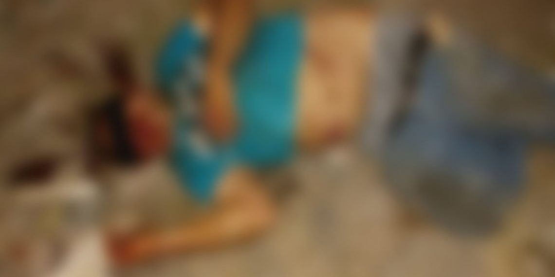 Le dieron dos machetazos en la cabeza en una riña