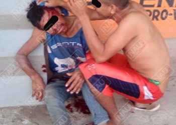 Casi se mata al caer de su propia altura