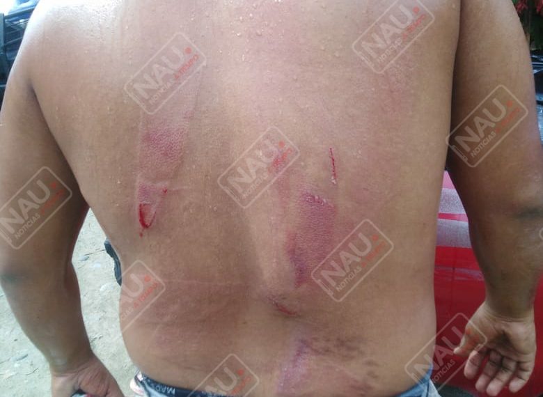 Padre e hijos intentaron asesinar a una persona