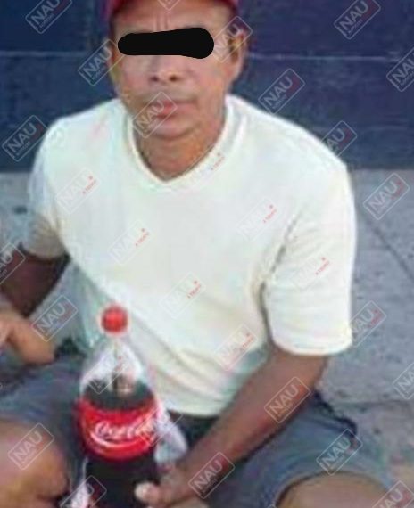 Muere señora que recibió un machetazo en la cabeza