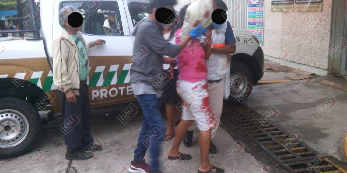 Empleada de una tortillería pierde el brazo en su centro de labores