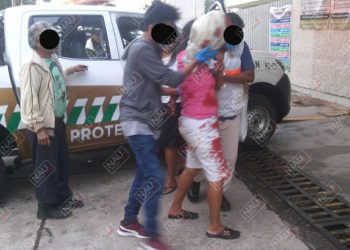Empleada de una tortillería pierde el brazo en su centro de labores