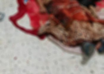 Guatemalteco intentó quitarse la vida