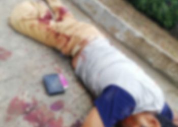 Entre la vida y la muerte