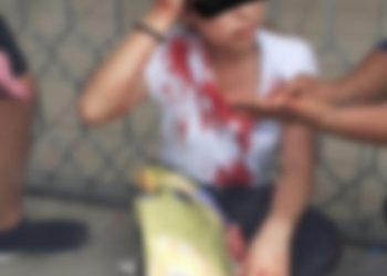 Una joven fue lesionada al oponerse a ser asaltada en el centro de Tapachula