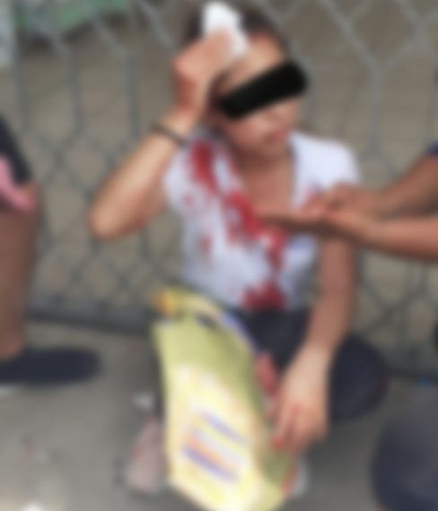 Una joven fue lesionada al oponerse a ser asaltada en el centro de Tapachula