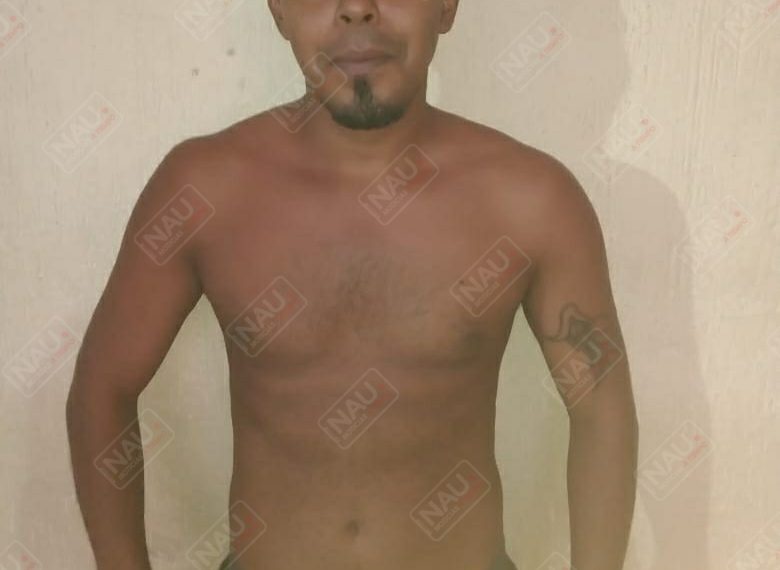 Casi le arrancan el brazo de un machetazo