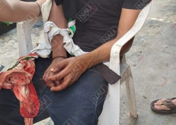 En riña lo machetearon