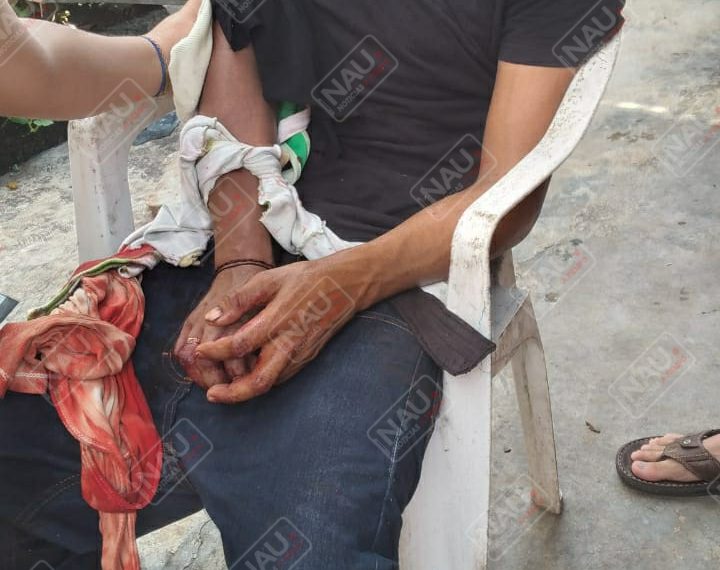 En riña lo machetearon