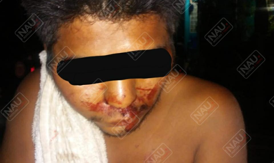 Enfermo mental estaba arriba de una casa y lo confundieron con delincuente