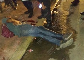 Padece de ataques epilépticos y se cayó de su propia altura