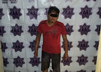 Lesionó a su esposa a golpes y a su hermano con un vidrio de un espejo