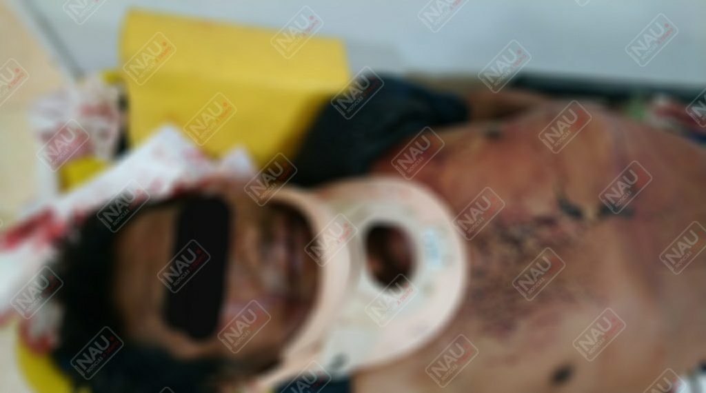 Ingresó el pasado domingo al Hospital y falleció la tarde de este miércoles