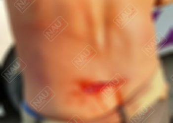 Le dieron una cuchillada en una riña