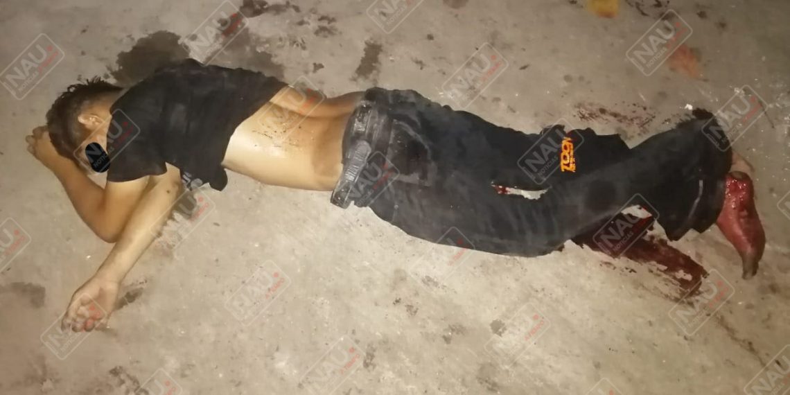 Machetean al Pañalito en una riña