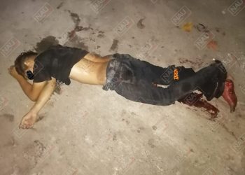 Machetean al Pañalito en una riña