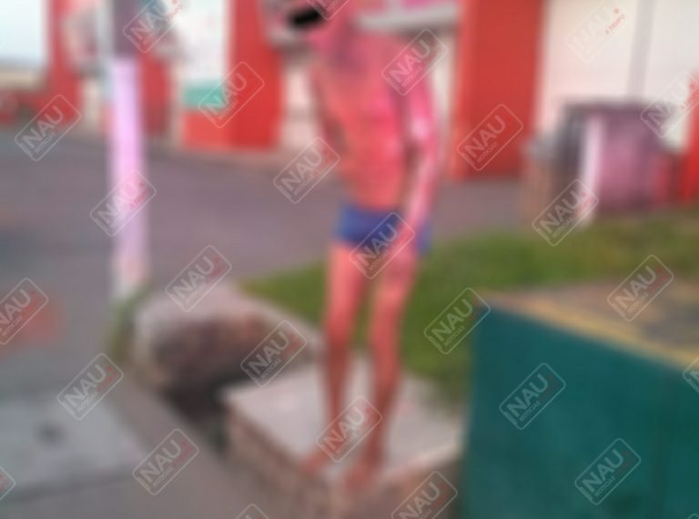 Un indigente resultó con quemaduras de 2° grado al explotar un transformador