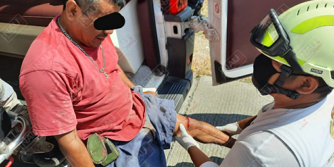 Motociclista con lesiones leves al ser impactado por un taxi