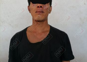 Salvadoreño lesionó con cuchillo a despachador de gasolina Repsol en asalto