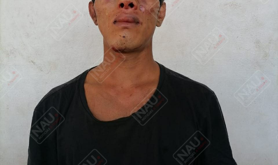 Salvadoreño lesionó con cuchillo a despachador de gasolina Repsol en asalto