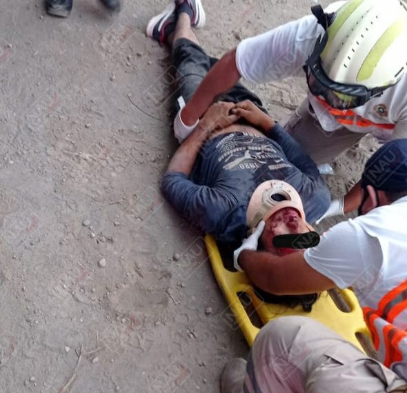 Ebrio se cayó de su motocicleta y se ocasionó lesiones