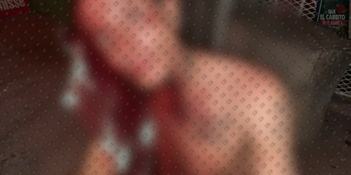 Hieren a Barrio 18 en la Colonia Xochimilco