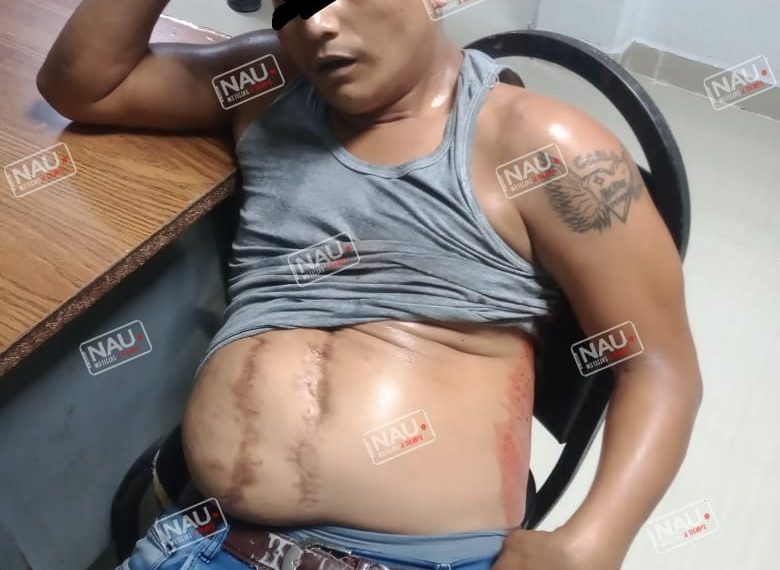 Lo mataron de un balazo