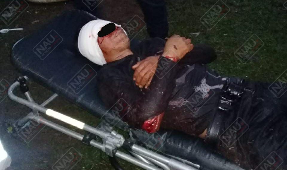 Ingresó al HG de Tapachula, fue macheteado por su amigo de parranda