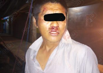 Detienen a dos por pelearse en la vía pública