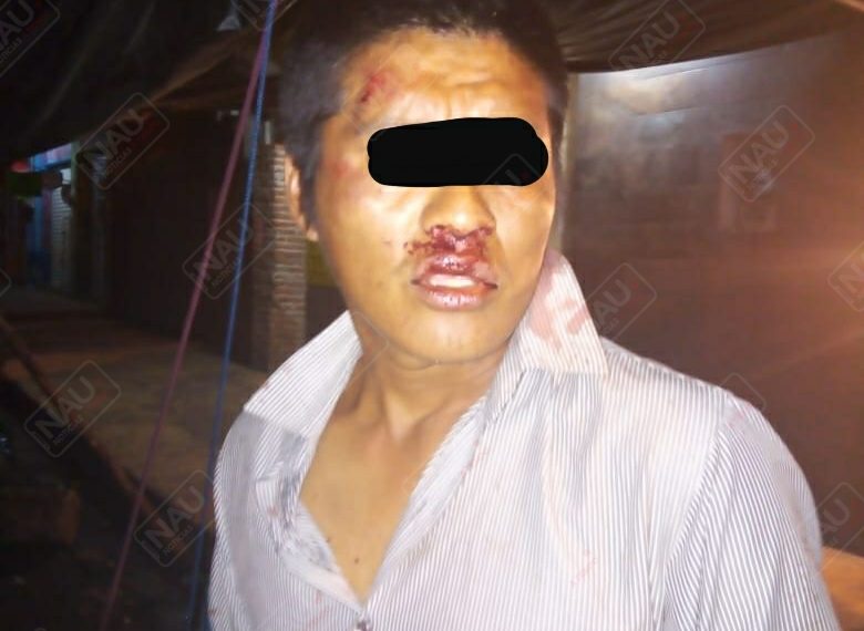 Detienen a dos por pelearse en la vía pública