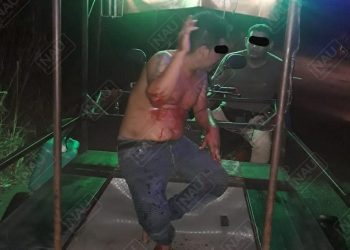 Golpeador de mujer fue lesionado de un machetazo en la mano