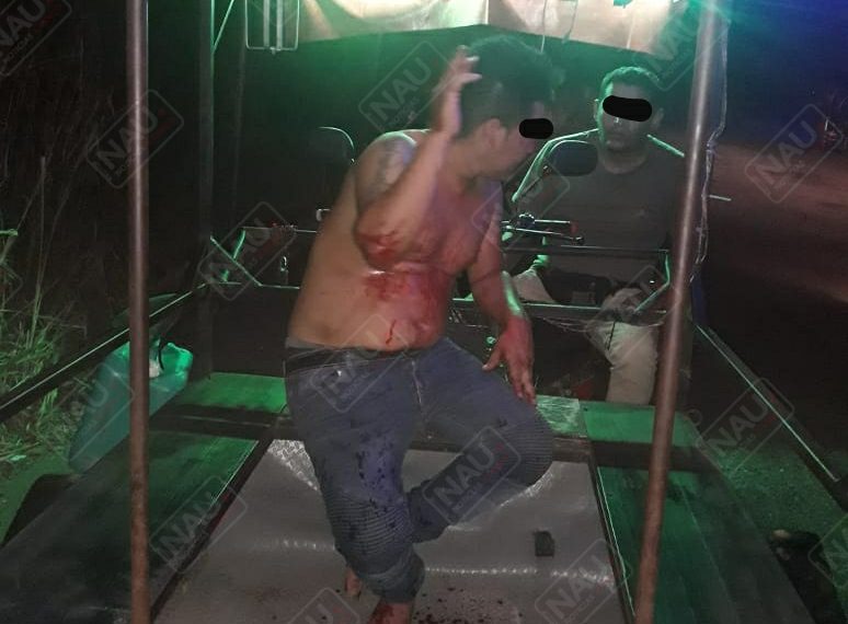 Golpeador de mujer fue lesionado de un machetazo en la mano