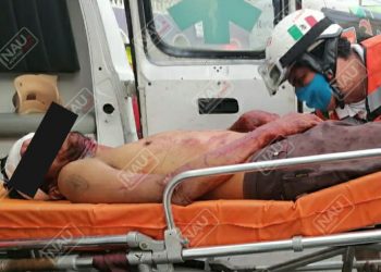 Le dieron dos cuchilladas en la cara en una riña.