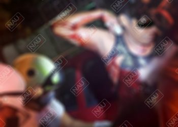 Casi lo matan a cuchilladas