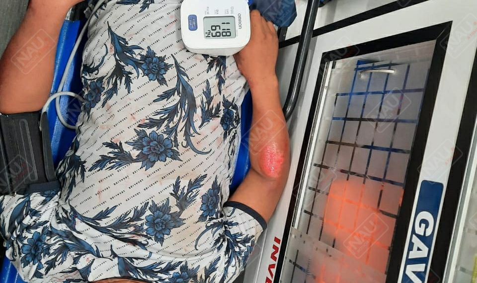 Derrapó en su motocicleta en el Barrio San Jacinto de Huehuetán