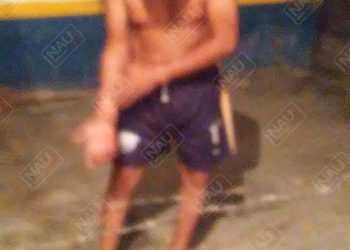 Se peleó con su esposa y le dio una cuchillada