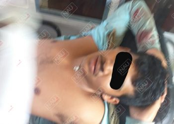 Campesino fue baleado para despojarle su motocicleta