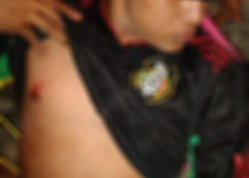 Le dieron una cuchillada en el pecho