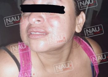 Salvadoreña lesionó de una cuchillada a su connacional