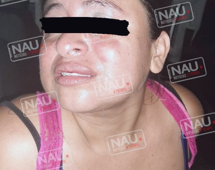 Salvadoreña lesionó de una cuchillada a su connacional