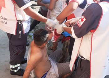 Podaba su césped y se cortó por accidente