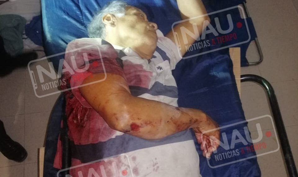 Su vecino le dio un balazo y murió en el Hospital de Tapachula.