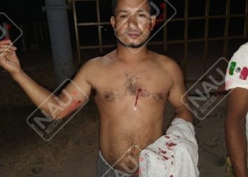 Le dispararon para robarle su motocicleta en Mazatán