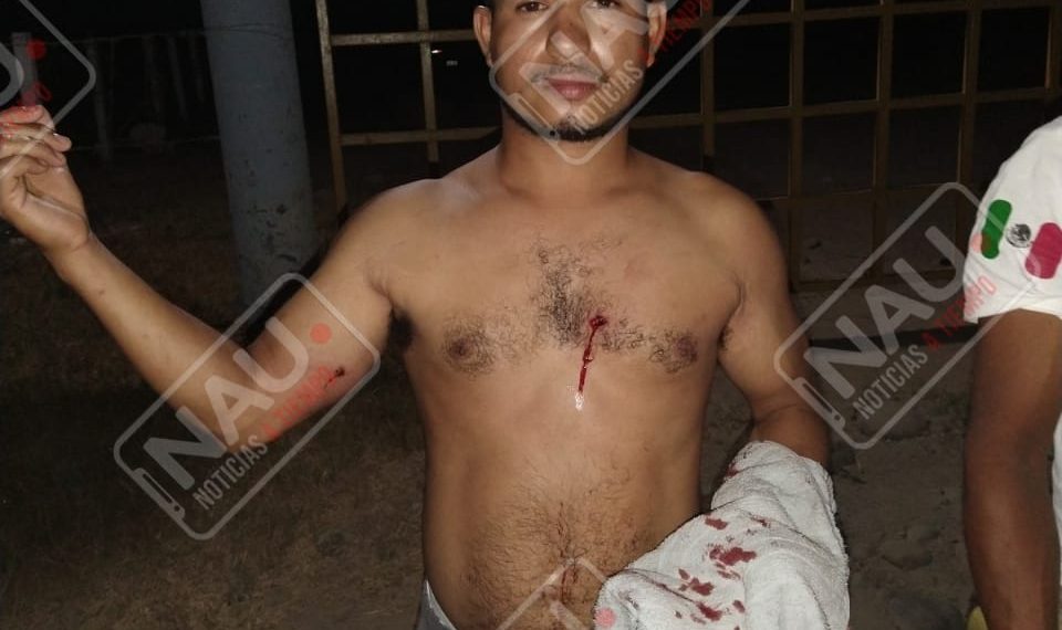 Le dispararon para robarle su motocicleta en Mazatán