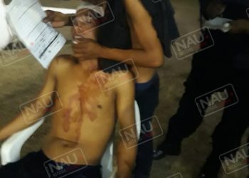 Riña deja un lesionado en la cabeza en Suchiate