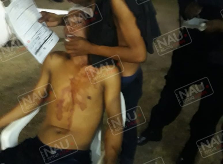 Riña deja un lesionado en la cabeza en Suchiate