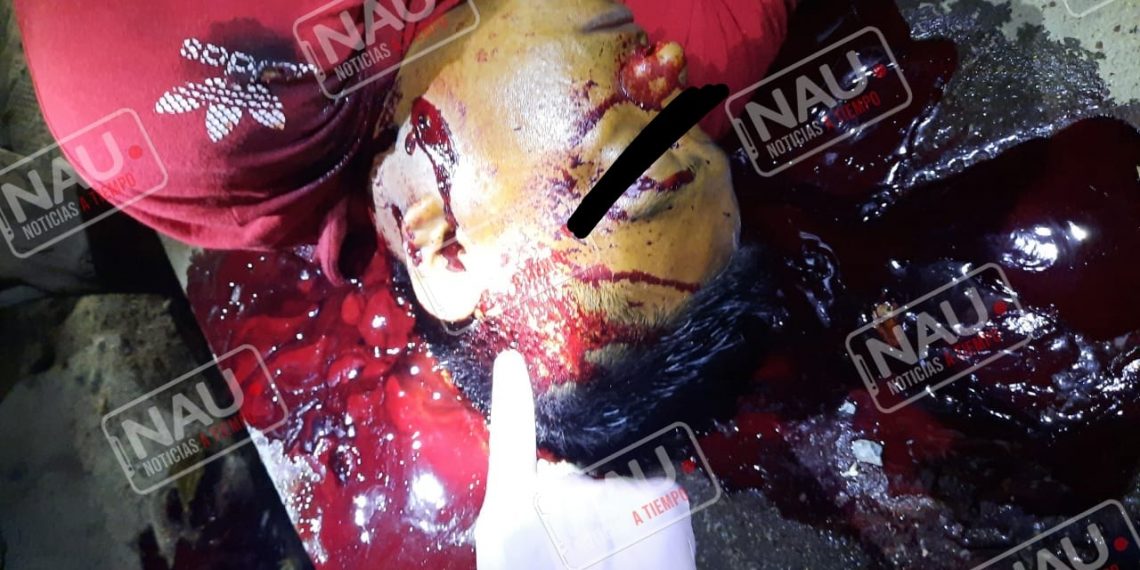 Le dieron 5 balazos en el momento que se encontraba ingiriendo bebidas embriagantes en Huehuetán